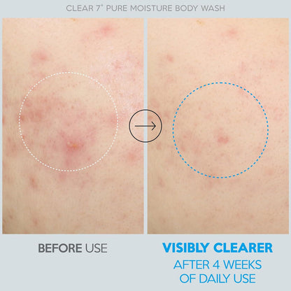Troubless Clear 7 Plus Pure Moisture Body Wash